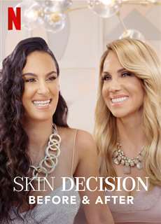 Lựa Chọn Lột Xác: Trước Và Sau - Skin Decision: Before And After - (2020) - phim3mien.com Website xem phim miễn phí tốt nhất