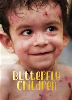 Những đứa trẻ da cánh bướm - Butterfly Children - (2018) - phim3mien.com Website xem phim miễn phí tốt nhất